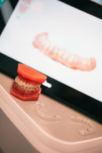 A dental model with braces sits on a counter next to clear aligners, with a digital image of teeth displayed on a screen in the background.